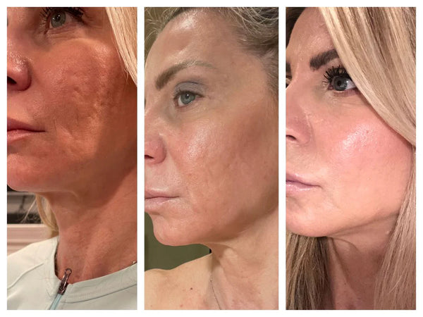 Radiant Glow Facial Wand