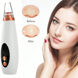 Handy Pore Electric Blackhead Remover Margot Vital