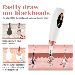 Handy Pore Electric Blackhead Remover Margot Vital