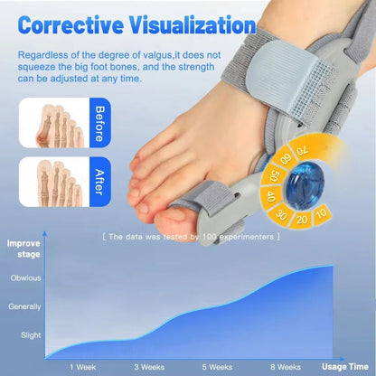 FlexAlign™ 180° Toe Wrap | Lightweight Comfort Accessory