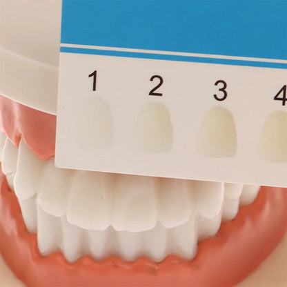 [FREE] Professional Teeth Whitening Shade Guide Margot Vital